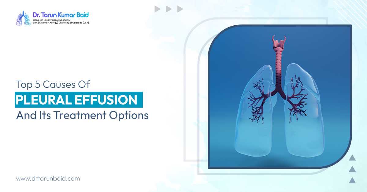 Causes Of Pleural Effusion And Its Treatment