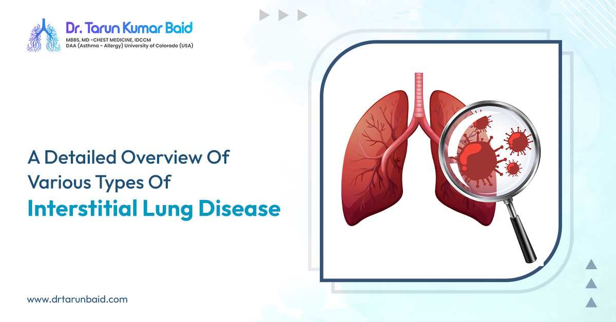 Various Types Of Interstitial Lung Disease