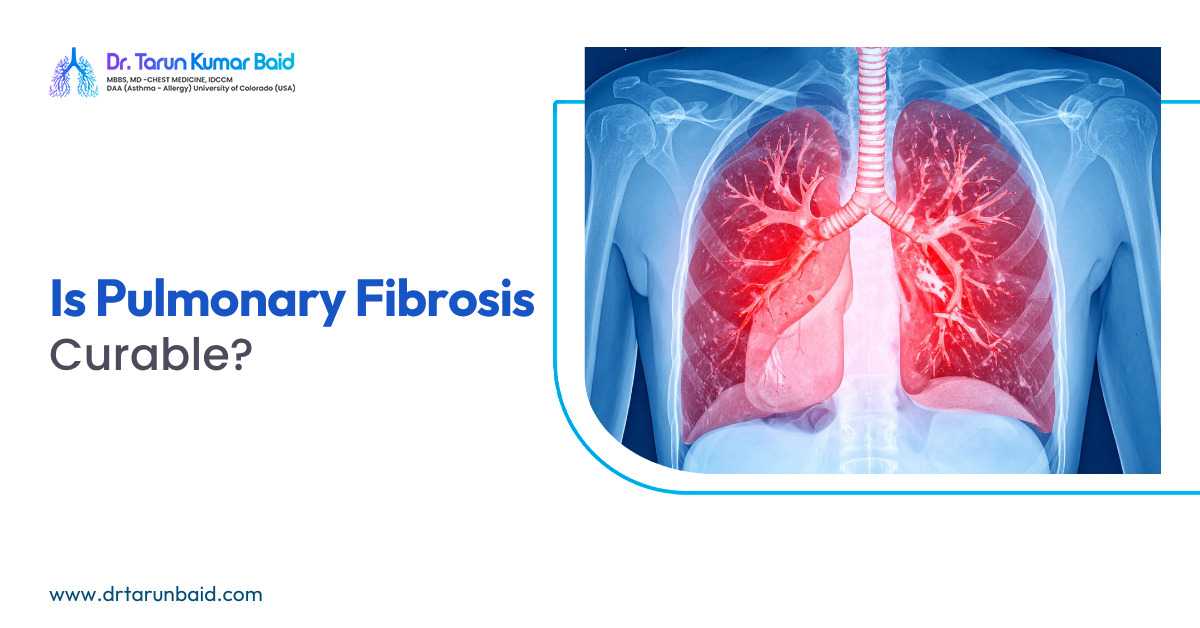 Is Pulmonary Fibrosis Curable? Medical illustration showing lung scarring caused by pulmonary fibrosis by Dr. Tarun Kumar Baid