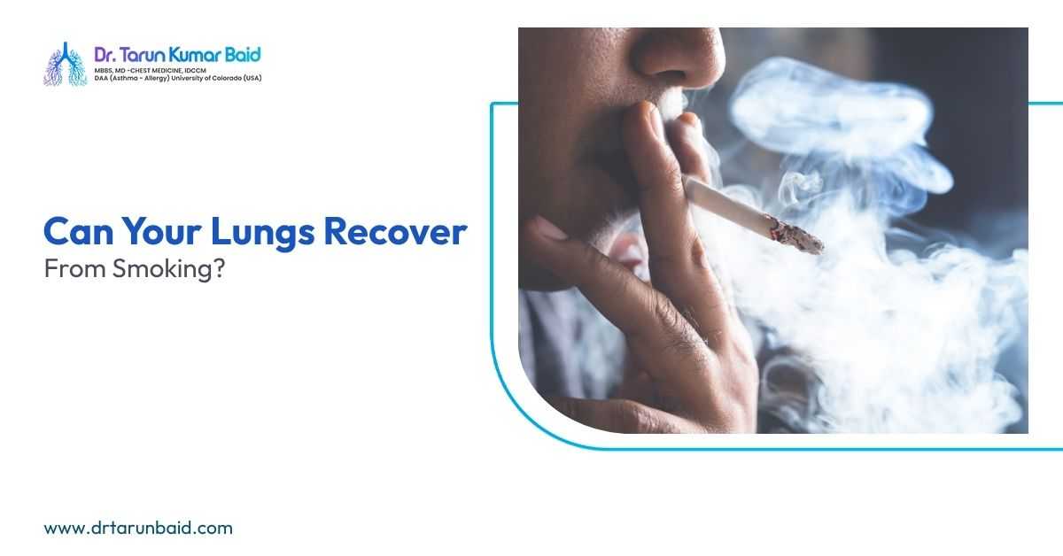 Smoking and lung recovery awareness by Dr Tarun Baid, top pulmonologist in Siliguri