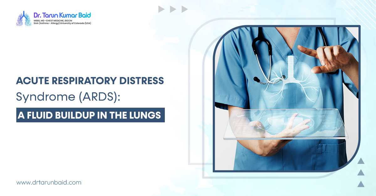 Acute Respiratory Distress Syndrome (ARDS) A Fluid Buildup In The Lungs