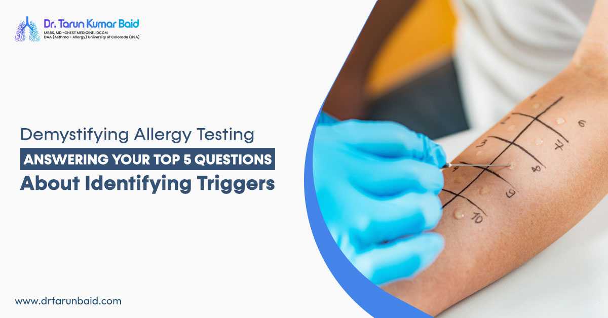Allergy Test in Siliguri