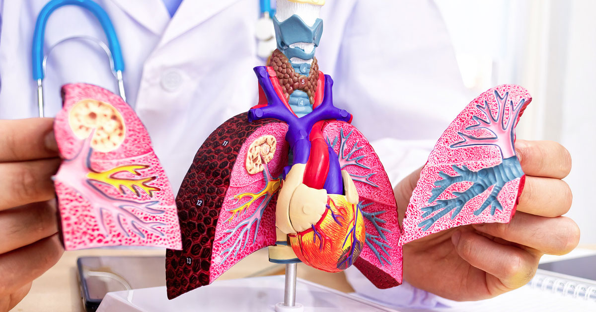 lungs specialist doctor in Siliguri
