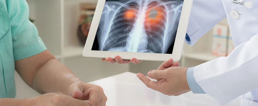 lung-infection-screening